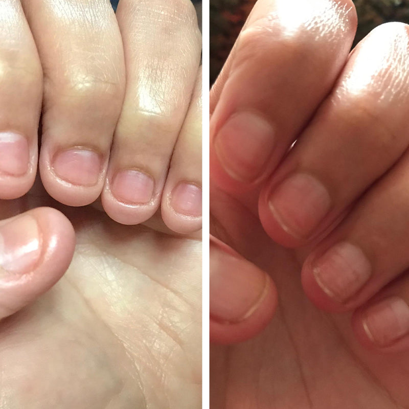 Avtoit | Nail Nutrient Oil Pen