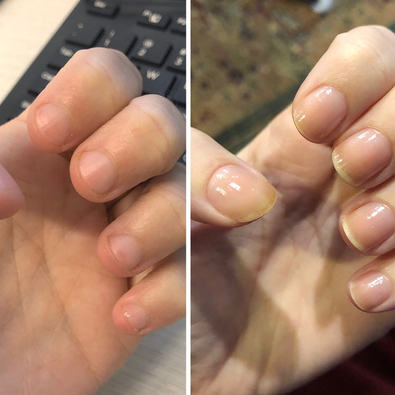Avtoit | Nail Nutrient Oil Pen