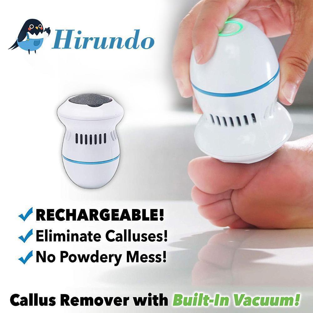Avtoit | FootFile and Callus Remover