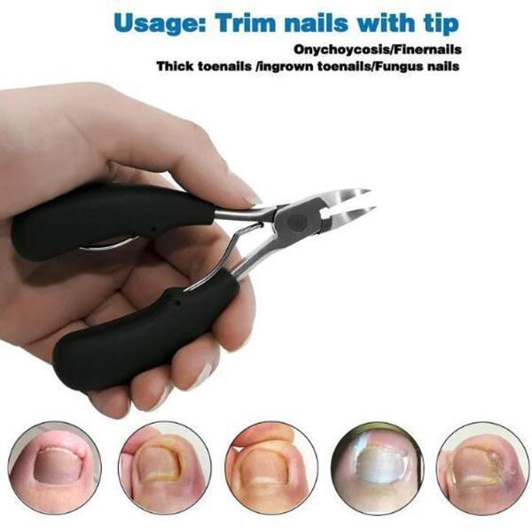 Avtoit | Medical nail clipper