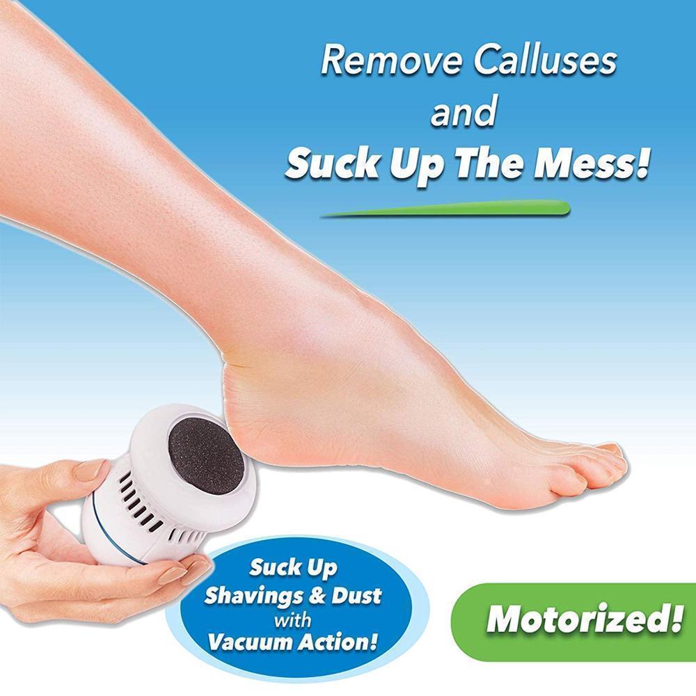 Avtoit | FootFile and Callus Remover