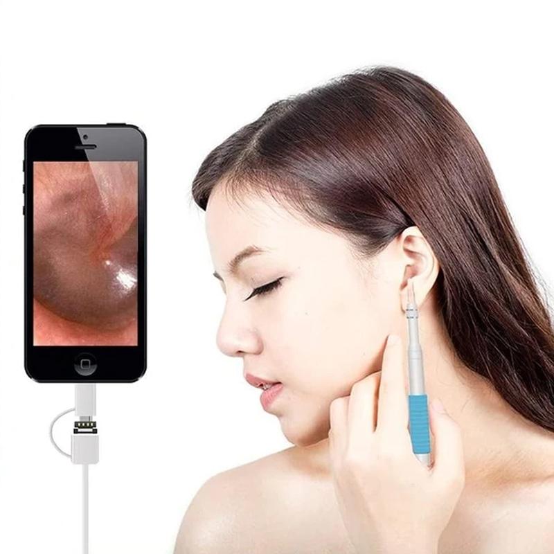 Avtoit | Household ENT Endoscope