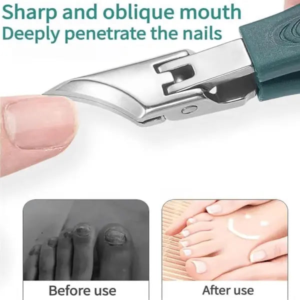 Avtoit | 3-piece nail care set for ingrown nails