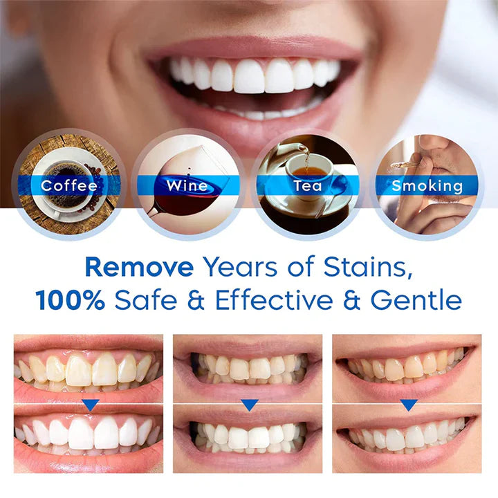 Avtoit | Tooth Whitening Pens