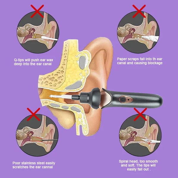 Avtoit | Painless Ear Wax Removal Kit – Safe & Effective Cleaning for the Whole Family