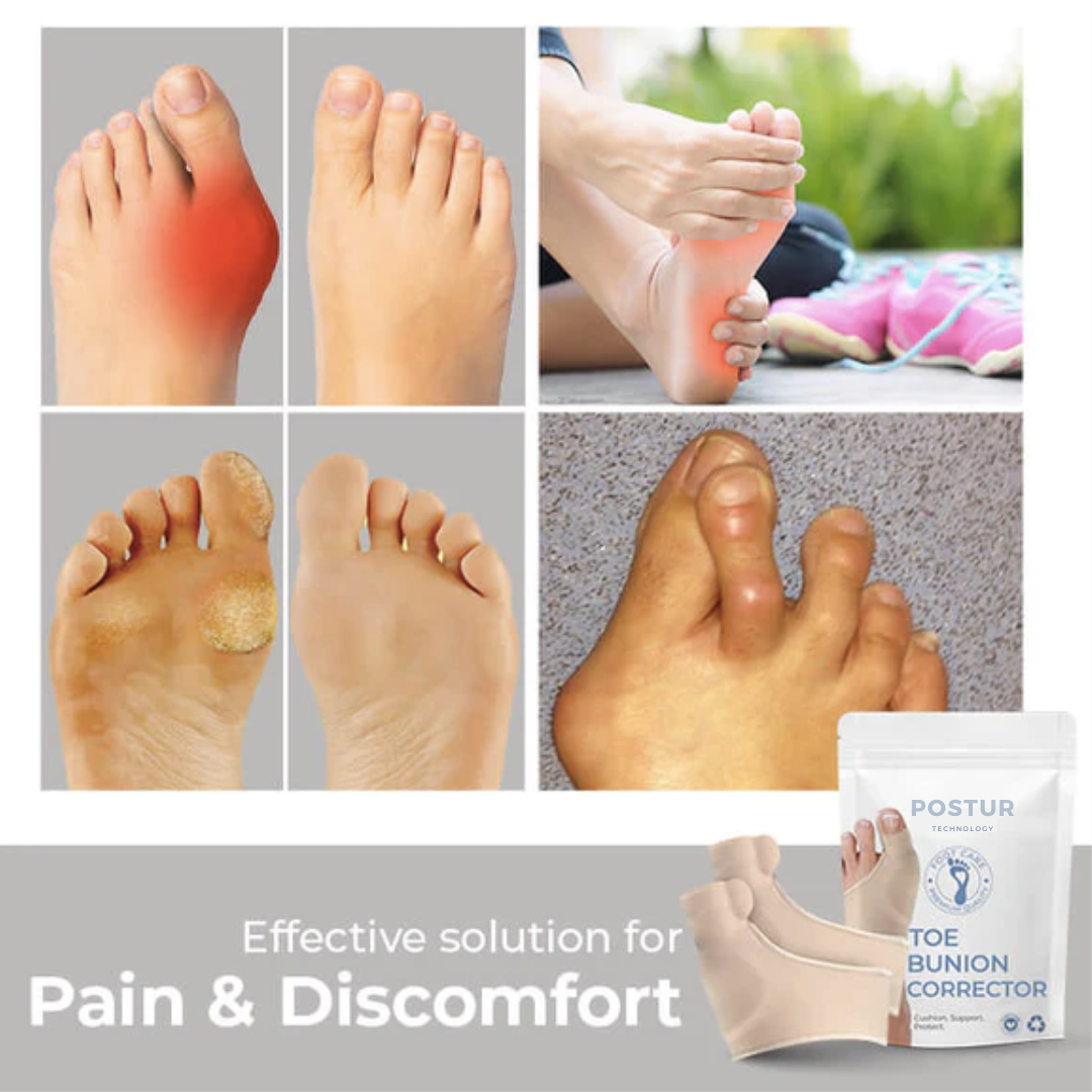 Avtoit | Hallux Valgus Corrector 2.0 – corrective support – pain relief – comfortable – wall clock