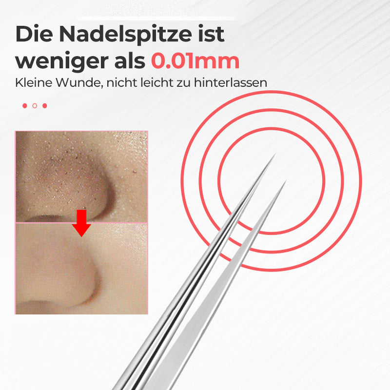 Avtoit | Tweezer for Removing Blackheads on the Face