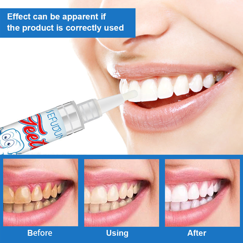 Avtoit | Tooth Whitening Gel Pen