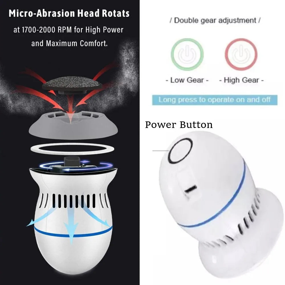 Avtoit | Vacuum Callus Remover