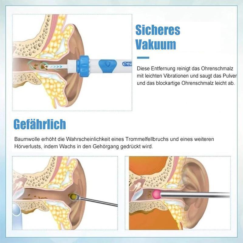 Avtoit | Earwax remover vacuum