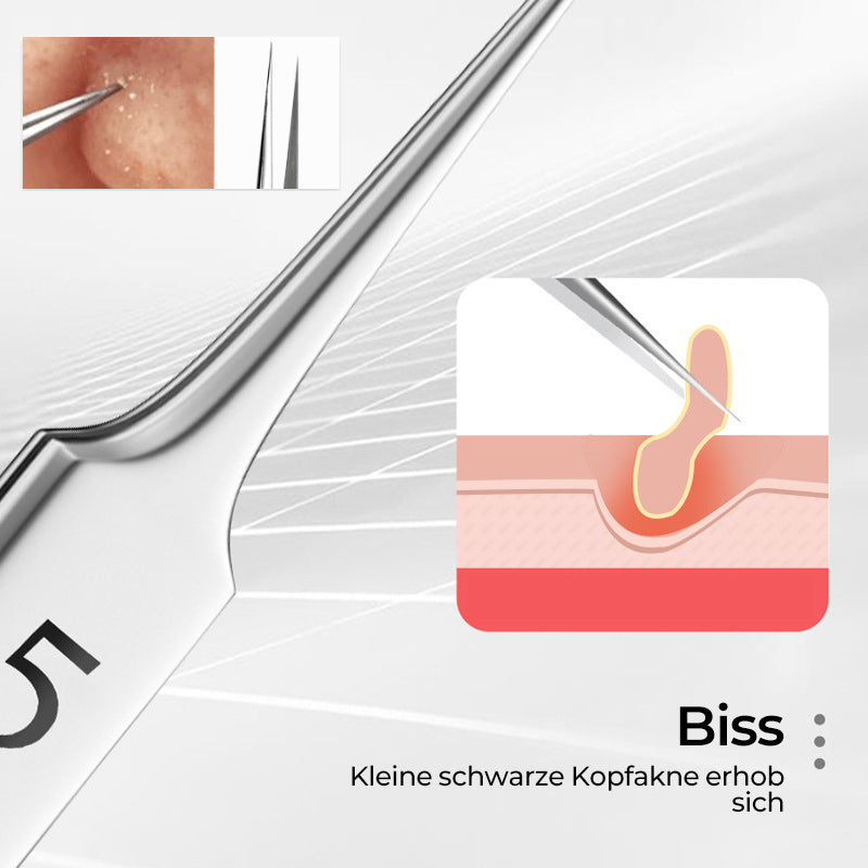 Avtoit | Tweezer for Removing Blackheads on the Face