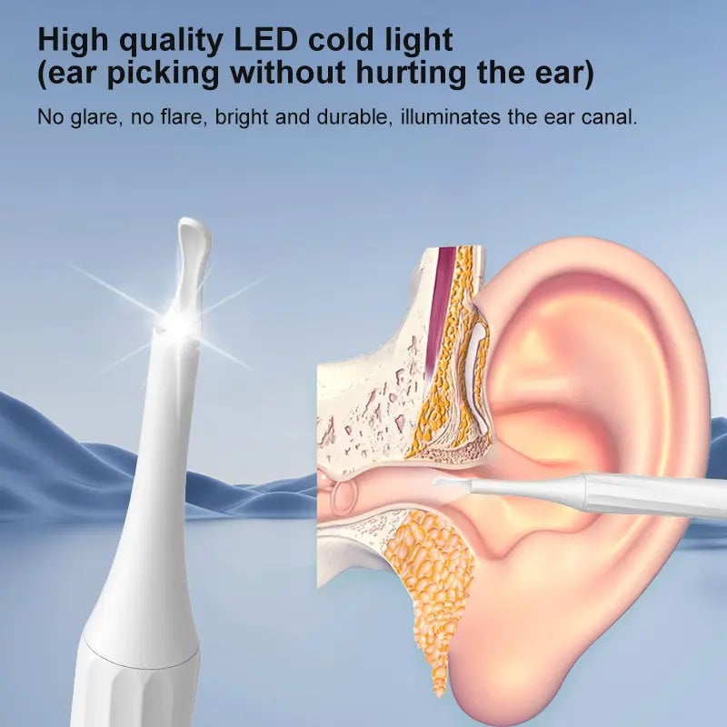Avtoit | HD Camera Ear Wax Remover Kit