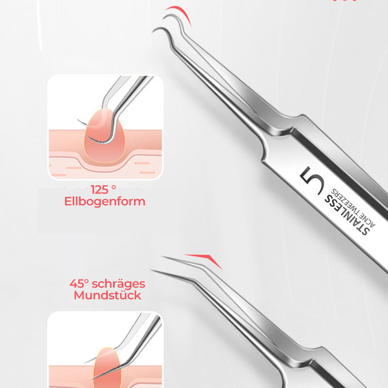Avtoit | Tweezer for Removing Blackheads on the Face