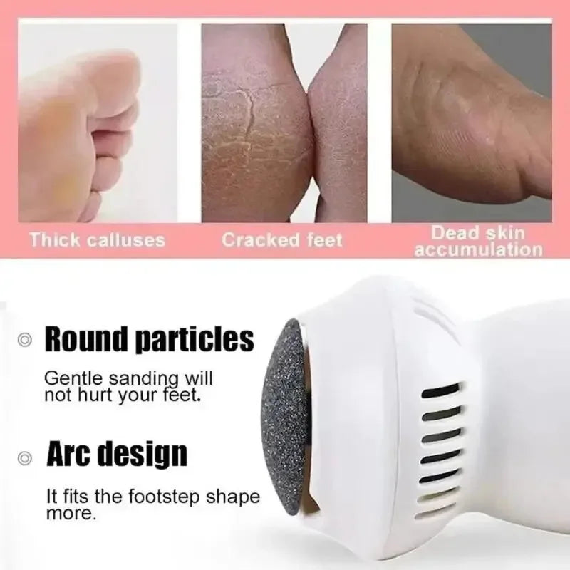 Avtoit | Electric Professional Callus Remover