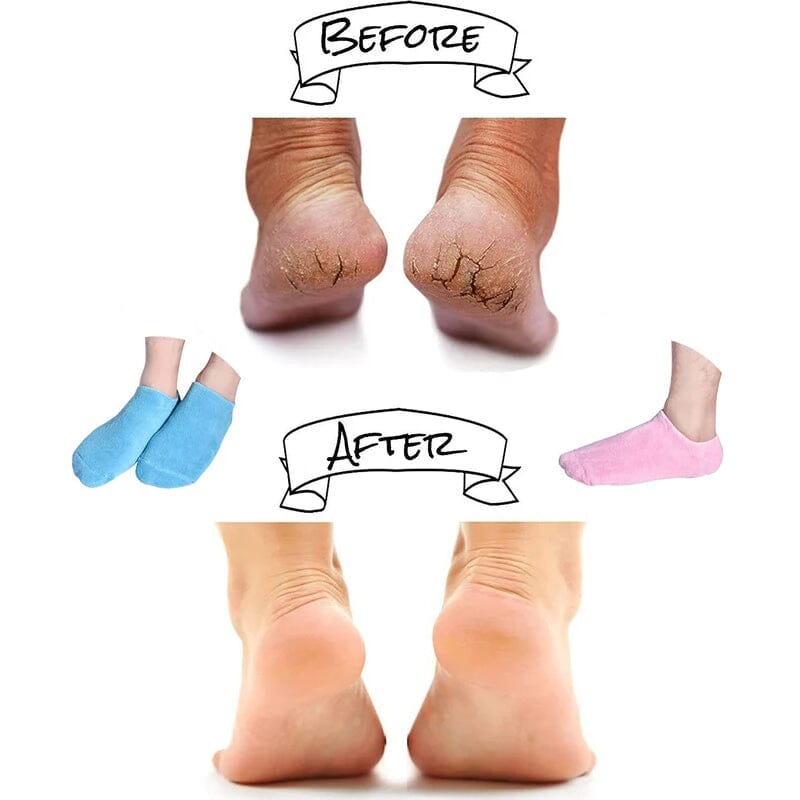 Avtoit | Moisturizing socks with gel lining