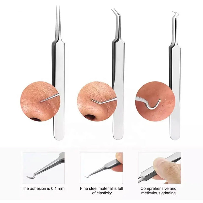 Avtoit | Tweezer for Removing Blackheads on the Face