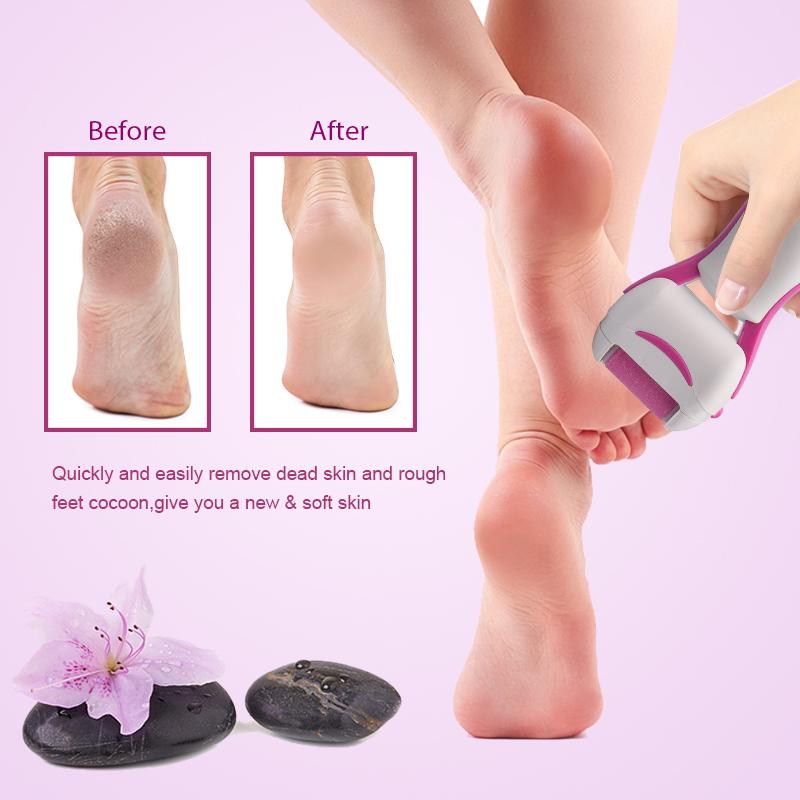 Avtoit | Electric Pedicure Tool