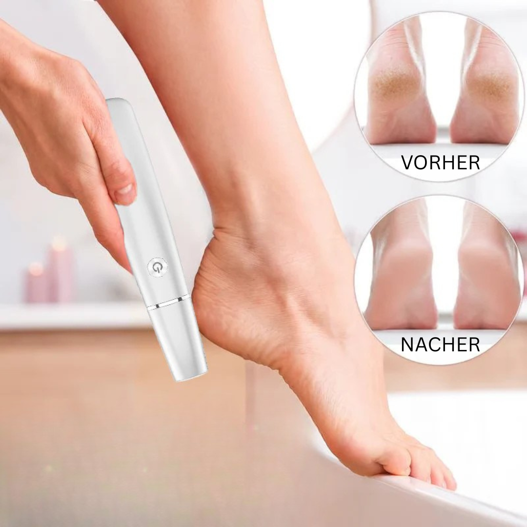 Avtoit | Electric Callus Remover for the Feet
