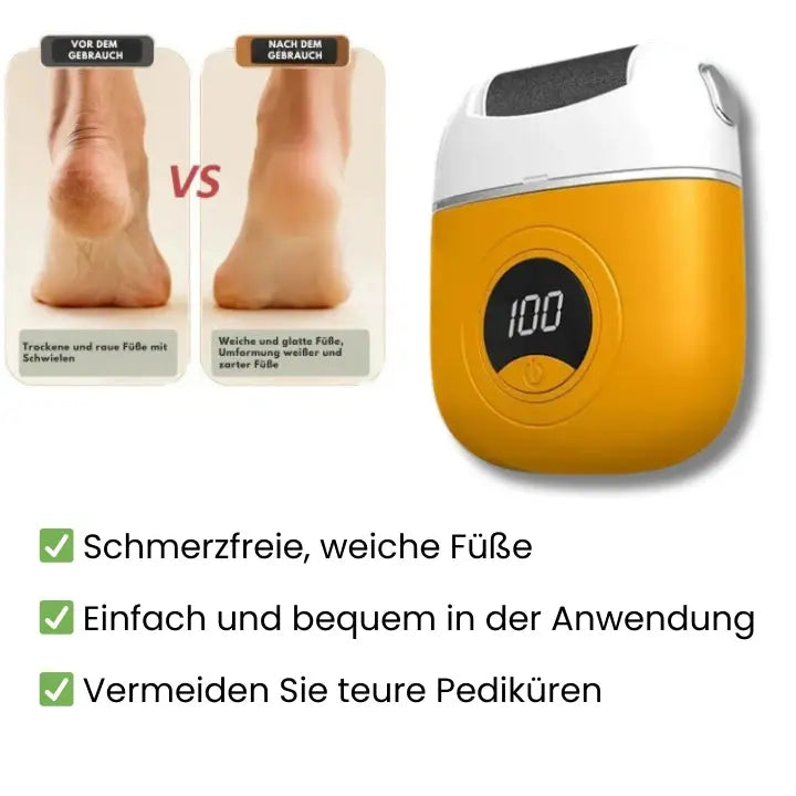 Avtoit | Electric callus remover for smooth feet