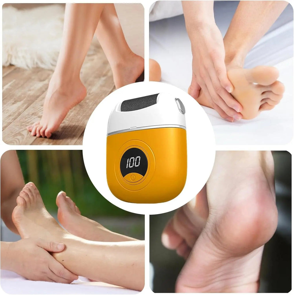 Avtoit | Electric callus remover for smooth feet