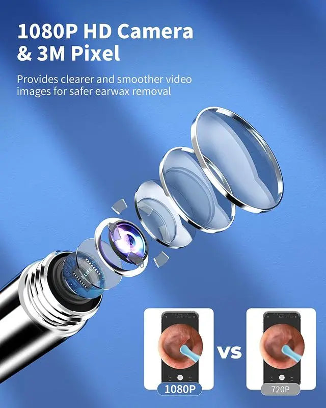 Avtoit | HD Earwax Removal Spoon — Wireless Otoscope with LED Light