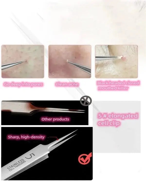 Avtoit | Professional Tweezers Set
