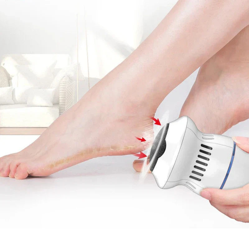 Avtoit | Electric Professional Callus Remover