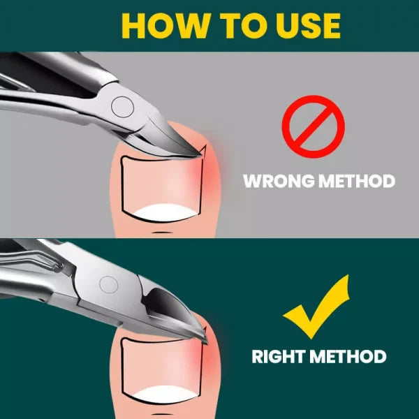 Avtoit | Orthopedic Nail Clipper