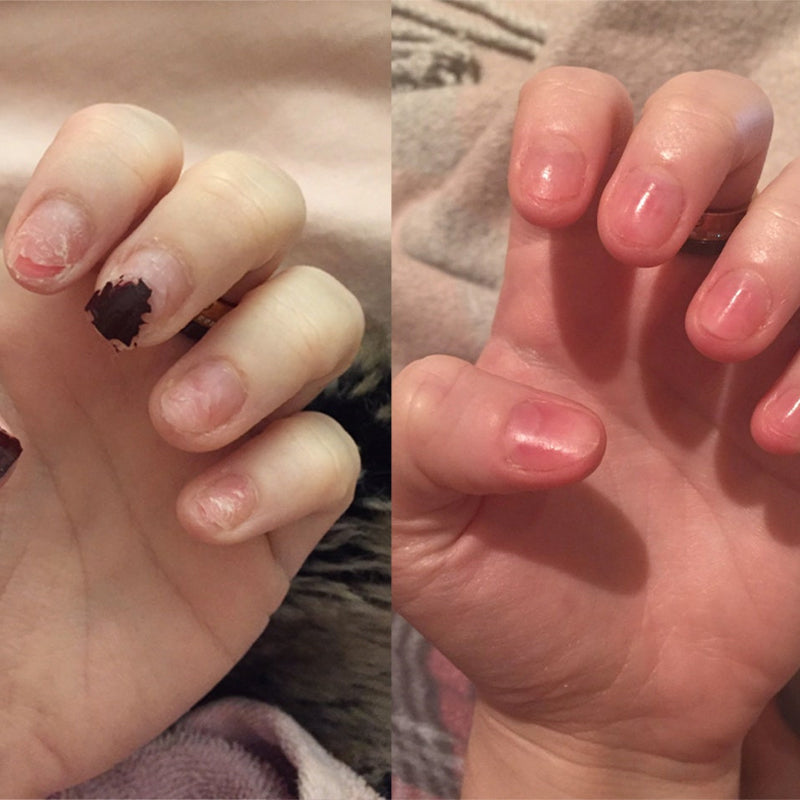 Avtoit | Nail Nutrient Oil Pen