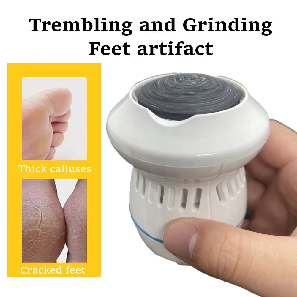 Avtoit | Vacuum Callus Remover